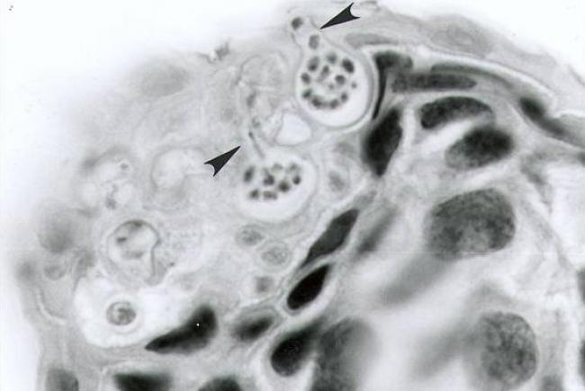 The chytrid, a pathogenic fungus