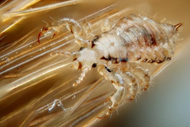 Pediculus humanuscapitis